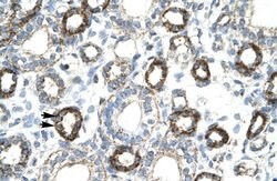 FOXF2 Polyclonal Antibody:Antibodies, Polyclonal