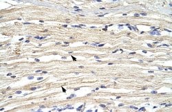 Invitrogen KDM2A Polyclonal Antibody 100 &mu;L; Unconjugated:Antibodies,