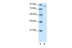 Invitrogen KDM2A Polyclonal Antibody 100 &mu;L; Unconjugated:Antibodies,