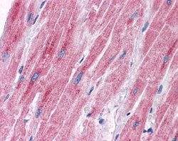 Invitrogen PDK2 Polyclonal Antibody 100 &mu;L; Unconjugated:Antibodies,