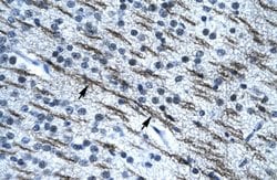 Invitrogen SSBP2 Polyclonal Antibody 100 &mu;L; Unconjugated:Antibodies,