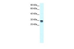 Invitrogen SSBP2 Polyclonal Antibody 100 &mu;L; Unconjugated:Antibodies,