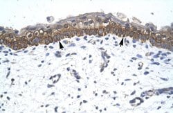 Invitrogen ZNF385A Polyclonal Antibody 100 &mu;L; Unconjugated:Antibodies,