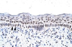 Invitrogen ZNF500 Polyclonal Antibody 100 &mu;L; Unconjugated:Antibodies,