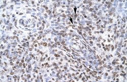 Invitrogen ZNF500 Polyclonal Antibody 100 &mu;L; Unconjugated:Antibodies,