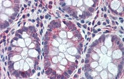 Invitrogen GATA6 Polyclonal Antibody 100 &mu;L; Unconjugated:Antibodies,