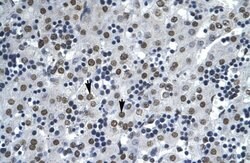 Invitrogen AATF Polyclonal Antibody 100 &mu;L; Unconjugated:Antibodies,