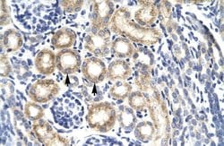 Invitrogen KChIP3 Polyclonal Antibody 100 &mu;L | Buy Online | Invitrogen&trade; | Fisher Scientific