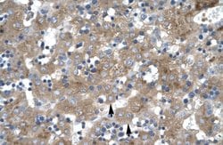 Invitrogen ZNF81 Polyclonal Antibody 100 μL; Unconjugated:Antibodies,