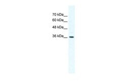 Invitrogen DVL1 Polyclonal Antibody 100 &mu;L; Unconjugated:Antibodies,