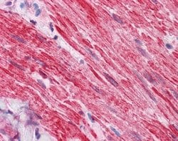 Invitrogen DVL2 Polyclonal Antibody 100 &mu;L; Unconjugated:Antibodies,