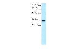 Invitrogen DBP Polyclonal Antibody 100 &mu;L | Buy Online | Invitrogen&trade; | Fisher Scientific