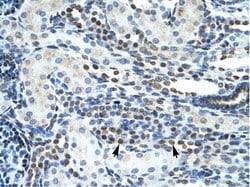 Invitrogen GSX2 Polyclonal Antibody 100 &mu;L; Unconjugated:Antibodies,