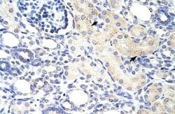 Invitrogen DLX3 Polyclonal Antibody 100 &mu;L; Unconjugated:Antibodies,