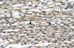 Invitrogen THRAP5 Polyclonal Antibody 100 &mu;L | Buy Online | Invitrogen&trade; | Fisher Scientific