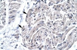 Invitrogen FOXE3 Polyclonal Antibody 100 &mu;L; Unconjugated:Antibodies,