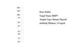 Invitrogen BMP-7 Polyclonal Antibody 100 &mu;L; Unconjugated:Antibodies,