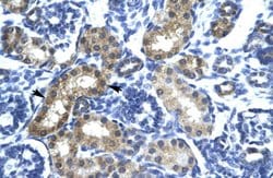 Invitrogen SIX6 Polyclonal Antibody 100 &mu;L; Unconjugated:Antibodies,