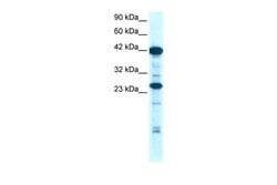 Invitrogen SIX6 Polyclonal Antibody 100 &mu;L; Unconjugated:Antibodies,