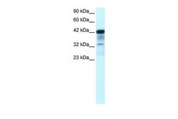 Invitrogen PLA1 Polyclonal Antibody 100 &mu;L; Unconjugated:Antibodies,