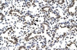Invitrogen ZNF385A Polyclonal Antibody 100 &mu;L; Unconjugated:Antibodies,