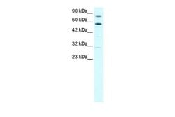 Invitrogen SND1 Polyclonal Antibody 100 &mu;L; Unconjugated:Antibodies,