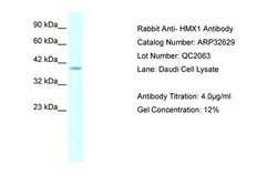 Invitrogen HMX1 Polyclonal Antibody 100 &mu;L; Unconjugated:Antibodies,