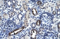 Invitrogen TSFM Polyclonal Antibody 100 &mu;L | Buy Online | Invitrogen&trade; | Fisher Scientific