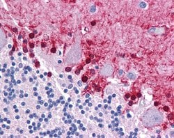 Invitrogen KLF2 Polyclonal Antibody 100 &mu;L | Buy Online | Invitrogen&trade; | Fisher Scientific