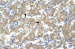 Invitrogen ACAT2 Polyclonal Antibody 100 &mu;L; Unconjugated:Antibodies,