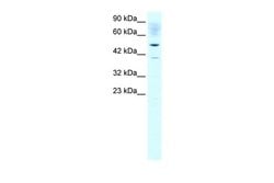 Invitrogen ACAT2 Polyclonal Antibody 100 &mu;L; Unconjugated:Antibodies,