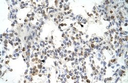 Invitrogen DLX5 Polyclonal Antibody 100 &mu;L; Unconjugated:Antibodies,