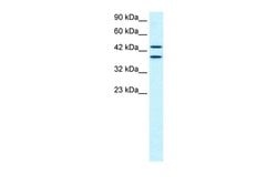 Invitrogen ZNF839 Polyclonal Antibody 100 &mu;L | Buy Online | Invitrogen&trade; | Fisher Scientific