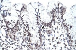 Invitrogen PHF1 Polyclonal Antibody 100 μL; Unconjugated:Antibodies,