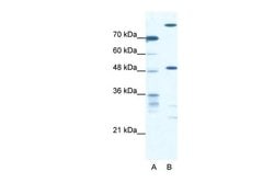 Invitrogen NFS1 Polyclonal Antibody 100 &mu;L; Unconjugated:Antikroppar