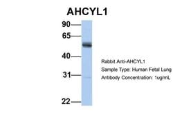 Invitrogen AdoHcyase 2 Polyclonal Antibody 100 &mu;L; Unconjugated:Antibodies,