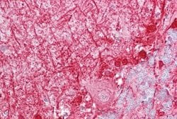Invitrogen Diazepam Binding Inhibitor Polyclonal Antibody 100 &mu;L | Buy Online | Invitrogen&trade; | Fisher Scientific