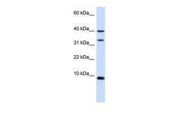 Invitrogen Diazepam Binding Inhibitor Polyclonal Antibody 100 &mu;L | Buy Online | Invitrogen&trade; | Fisher Scientific