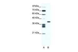 Invitrogen ALX4 Polyclonal Antibody 100 &mu;L; Unconjugated:Antibodies,