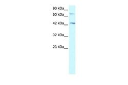 Invitrogen SEMA4A Polyclonal Antibody 100 μL; Unconjugated:Antibodies,