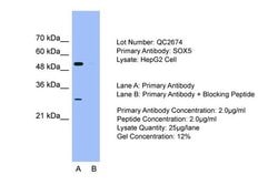 Invitrogen SOX5 Polyclonal Antibody 100 μL; Unconjugated:Antibodies,