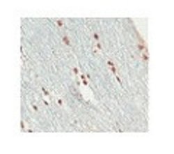 Invitrogen SOX10 Polyclonal Antibody 100 &mu;L | Buy Online | Invitrogen&trade; | Fisher Scientific