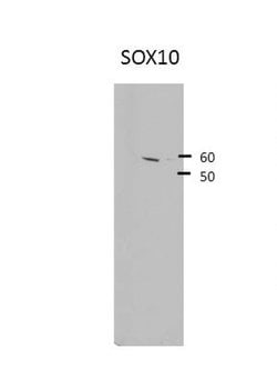 Invitrogen SOX10 Polyclonal Antibody 100 &mu;L | Buy Online | Invitrogen&trade; | Fisher Scientific