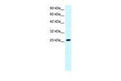 Invitrogen MEAF6 Polyclonal Antibody 100 &mu;L; Unconjugated:Antibodies,