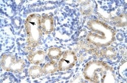 Invitrogen TBX1 Polyclonal Antibody 100 μL; Unconjugated:Antibodies,