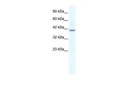 Invitrogen TBX1 Polyclonal Antibody 100 μL; Unconjugated:Antibodies,
