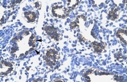 Invitrogen RPS16 Polyclonal Antibody 100 &mu;L; Unconjugated:Antibodies,