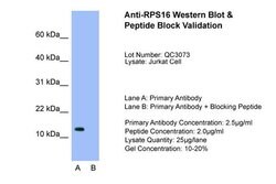 Invitrogen RPS16 Polyclonal Antibody 100 &mu;L; Unconjugated:Antibodies,