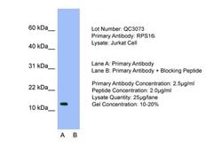 Invitrogen RPS16 Polyclonal Antibody 100 &mu;L; Unconjugated:Antibodies,