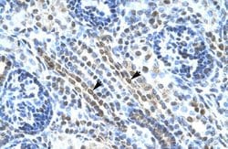 Invitrogen ANKRD11 Polyclonal Antibody 100 &mu;L; Unconjugated:Antibodies,